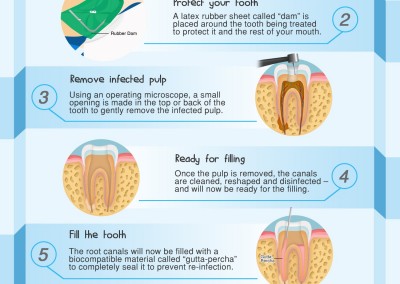 Melbourneseoservices.com Infographics - Endodontic Treatment Procedure: What Happens During a Root Canal?