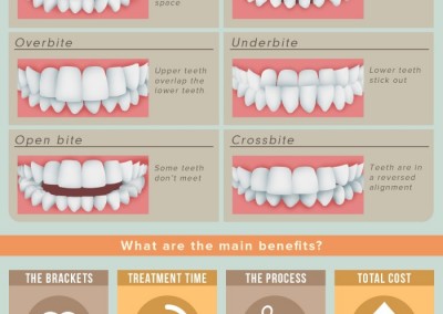 Melbourneseoservices.com Infographics - Six-Month Braces: The Modern Twist on Tried-and-True Orthodontics