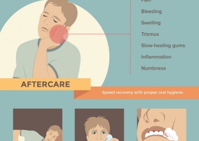 Melbourneseoservices.com Infographics - Wisdom Tooth Extraction: The Ultimate Survival Guide